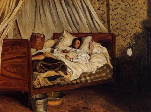 Frederic Bazille Monet after His Accident at the Inn of Chailly oil painting picture